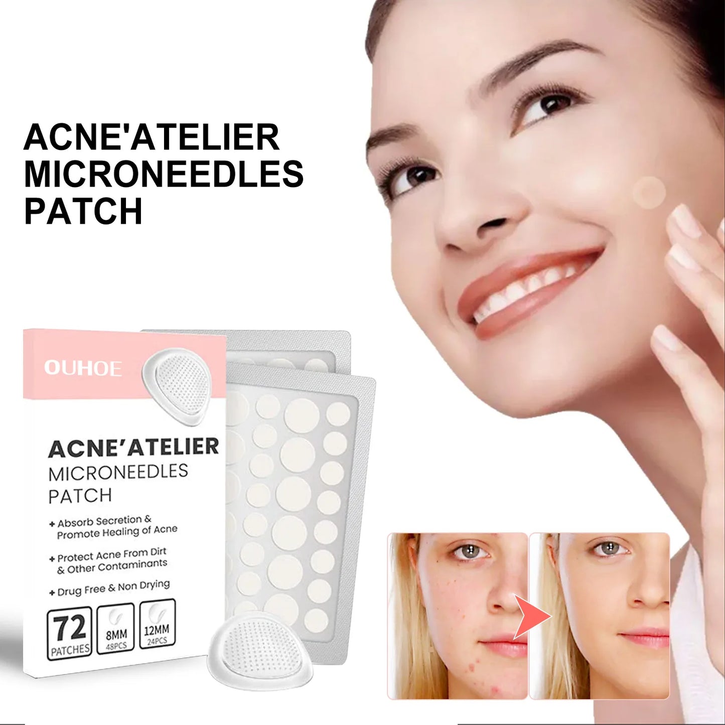 ClearSkin MagicPatch™: Invisible Pimple Healer