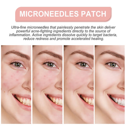 ClearSkin MagicPatch™: Invisible Pimple Healer